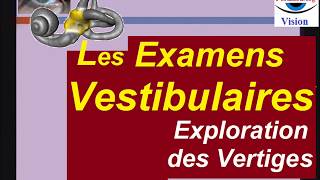 Différents examens vestibulaires diagnostic des vertiges [upl. by Cirdla]