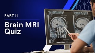 Brain MRI Quiz Part 2 [upl. by Anirb]