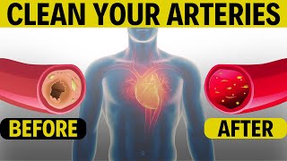 Top 7 Artery Cleansing Foods amp These Superfoods Prevent Heart Attacks [upl. by Theta]