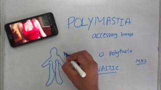 Polymastia [upl. by Iaw]