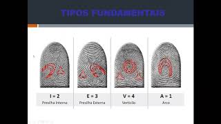 AULA 25  ANTROPOLOGIA FORENSE E IDENTIFICAÇÃO HUMANA P2 [upl. by Ibok]