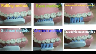 Comparison of Toothbrushing brushing techniques 칫솔질 방법 비교 [upl. by Maxima285]