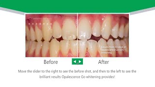 Opalescence Go  Take Home Teeth Whitening [upl. by Delorenzo787]