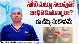 మూతి చుట్టూ నలుపు పోవాలంటే  How to Get Rid of Pigmentation Around the Mouth  Celestee Skin Clinic [upl. by Orelee]