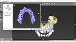 Straumann coDiagnostix Single Implant Guide with AI Assistant [upl. by Eynaffit848]