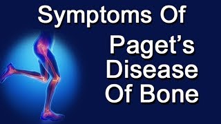 Symptoms Of Pagets Disease Of Bone [upl. by Lamoureux]