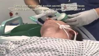 Intubation Extubation 6 7 YouTube [upl. by Nnayram272]