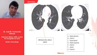 CLASE Nº3  Lectura de Tomografía de Tórax [upl. by Rurik]
