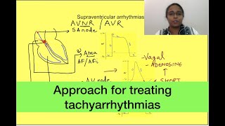 Treatment for tachyarrhythmias  Cardiovascular Medicine [upl. by Enaffit]