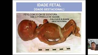 SEXOLOGIA FORENSE  parte 13  IDADE DO FETO  FÓRMULA DE HAASE [upl. by Neb]