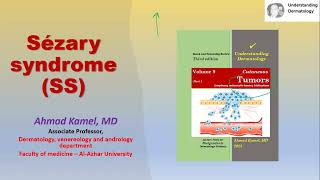 Sezary Syndrome SS part 1 [upl. by Diandra]