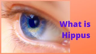 What is Hippus [upl. by Halfdan]