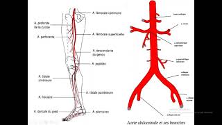 Ischémie arterielle aigue du membre inférieur  Dr LAKHAL [upl. by Notniuq80]