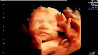 HDlive Ultrasound at 28 weeks Baby yawns and waves [upl. by Ahsieuqal]