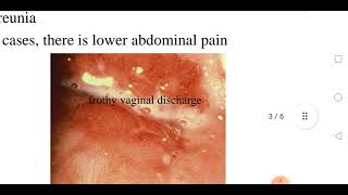 Trichomoniasis [upl. by Yema]