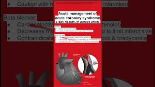 Acute management of acute coronary syndrome STEMI NSTEMI or unstable angina [upl. by Hares]