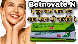 Betnovate N skin cream  Betamethasone Neomycin cream  Betnovate N cream [upl. by Dry]