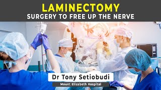 LAMINECTOMY  SURGERY FOR SPINAL STENOSIS [upl. by Peti]