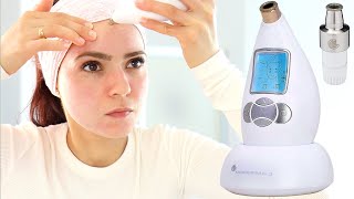 Microderm Glo Review amp How To Use  Microdermabrasion DIY Facial Treatment For Clear Skin [upl. by Pelson]