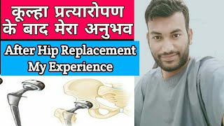 hip replacement experience हिप रिप्लेसमेंट के बाद ज़िन्दगी [upl. by Huskey]