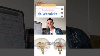 Nistagmo Signos cerebelosos y confusión ¿En qué te hacen pensar 🤔📚🧠 medicina educación [upl. by Hillhouse]