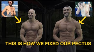 How We Fixed Our Sunken Chest Deformity with This Chest amp Ab Workouts [upl. by Notyal]