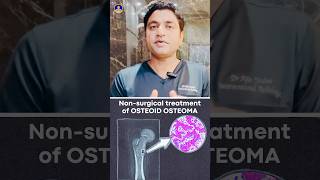 What are the NonSurgical Treatment of Osteoid Osteoma bonepain shorts [upl. by Nadya]