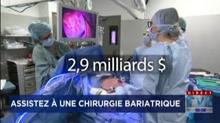 Entrevue sur la chirurgie bariatrique [upl. by Wallie]