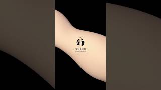 Painful Pronation Forearm [upl. by Sopher]