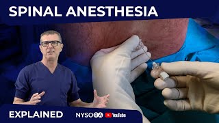 Spinal Anesthesia Explained Part 1 Crash course with Dr Hadzic [upl. by Morrell]