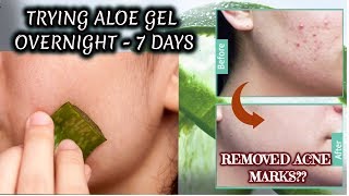 I applied fresh Aloe Vera gel on my face for 7 DAYS and THIS HAPPENED [upl. by Llennor904]