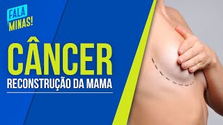 RECONSTRUÇÃO DA MAMA MASTOLOGISTA ESCLARECE DÚVIDAS [upl. by Ttsepmet]