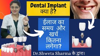 Dental Implant Procedure in Hindi Cost In India Time For Treatment DrShweta Sharma [upl. by Aihsoj866]