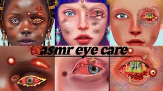 ASMR infected eye treatment  eye Worm 🐛 removal treatment asmr  different types treatment [upl. by Radec]