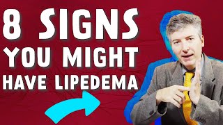 Learn About the 8 Signs That Indicate Lipedema Health of Your Legs [upl. by Oirotciv]