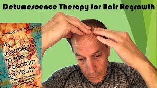 Detumescence TherapyCorrect Way to Perform Massages for Hair GrowthMy Journey to Fountain of Youth [upl. by Vivie]