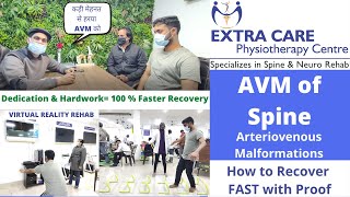 Arteriovenous Malformations in Hindi  AVM of Spine  100 Fast Recovery after LASER SURGERY [upl. by Thorr]