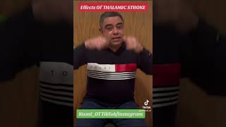 Effects of thalamic stroke [upl. by Ellehcan9]