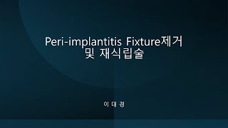 Periimplantitis Fixture제거 및 재식립술 [upl. by Abelard]