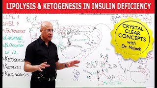 Lipolysis and Ketogenesis in severe Insulin Deficiency👨‍⚕️ [upl. by Nwahsyd]