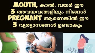 3 Early Pregnancy Symptoms Deechus world Malayalam [upl. by Anaet]