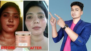 Nuskhe pigmentation cream by paras tomar  Review  Benefits and side effects [upl. by Holleran]