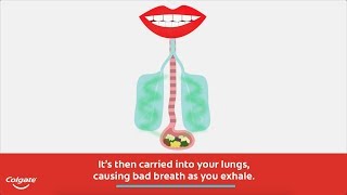 Explore the Causes of Bad Breath and Halitosis Remedies with Colgate® [upl. by Maurey]