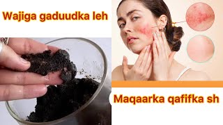 Wajiga gaduudka leh maqaarka qafifka amp qaleelka Alabtan marso diy skincare [upl. by Malchus850]