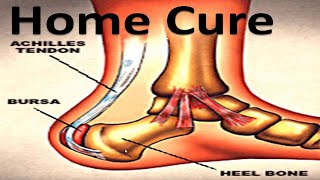 Heel Bursitis amp Achilles Tendon Bursitis Best HOME Treatment [upl. by Alyehs612]