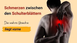 Die wahre Ursache für Schmerzen zwischen den Schulterblättern und wie Du sie beseitigst 💡 [upl. by Ilarrold117]