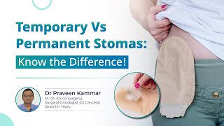 Stoma in Rectal Cancer Temporary Vs Permanent Stoma Which is good  Dr Praveen Kammar [upl. by Livingston]