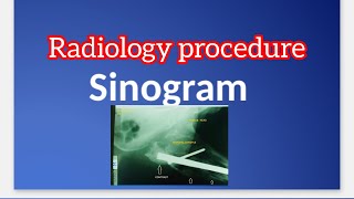 Sinogram  Radiographer Procedure  Ortho Procedure [upl. by Ytak424]