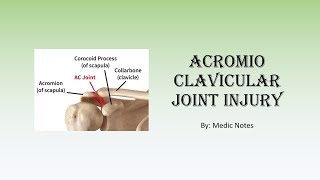 Acromioclavicular joint injury  causes Rockwood classification treatment complications [upl. by Jehanna]