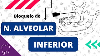 ANESTESIA MANDIBULAR  RESUMO MALAMED [upl. by Everrs]